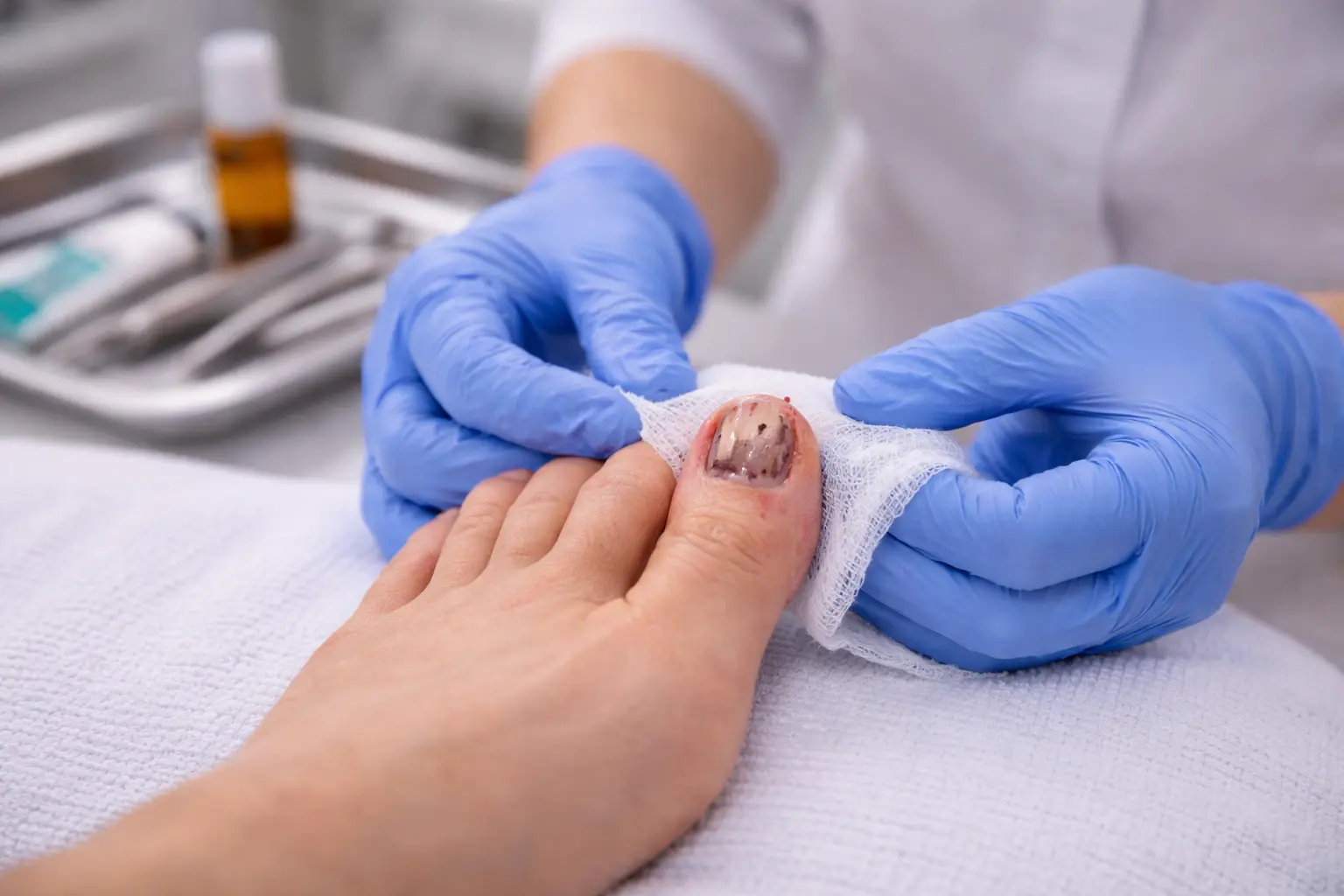 Podiatrist applying a dressing to a damaged toenail at General Foot Care clinic