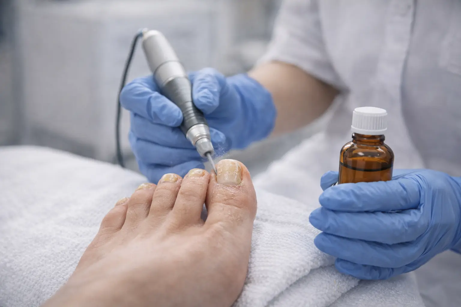 Podiatrist using a rotary drill to treat fungal toenails at General Foot Care podiatry clinic